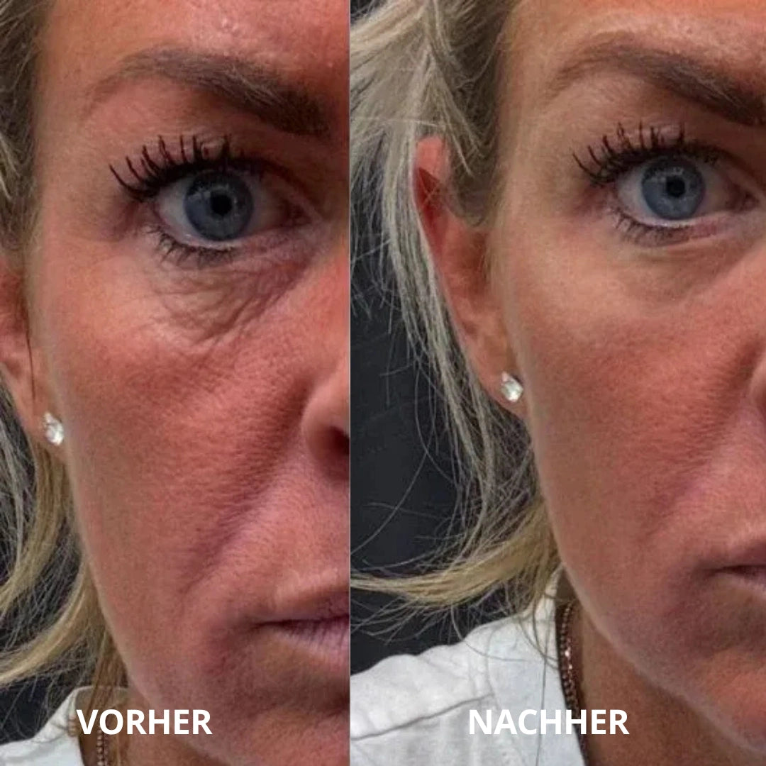 Neutra Glow™ Peptid-Kollagen Hydrogel-Augenpads