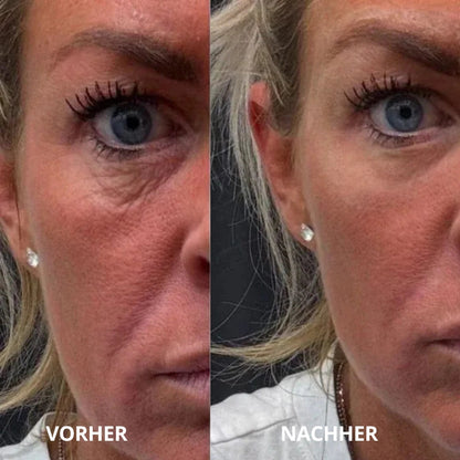 Neutra Glow™ Peptid-Kollagen Hydrogel-Augenpads
