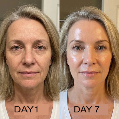 NeutraGlow™ Kollagenöl | Strafft und hebt schlaffe Haut innerhalb von 24 Stunden um 98 % an