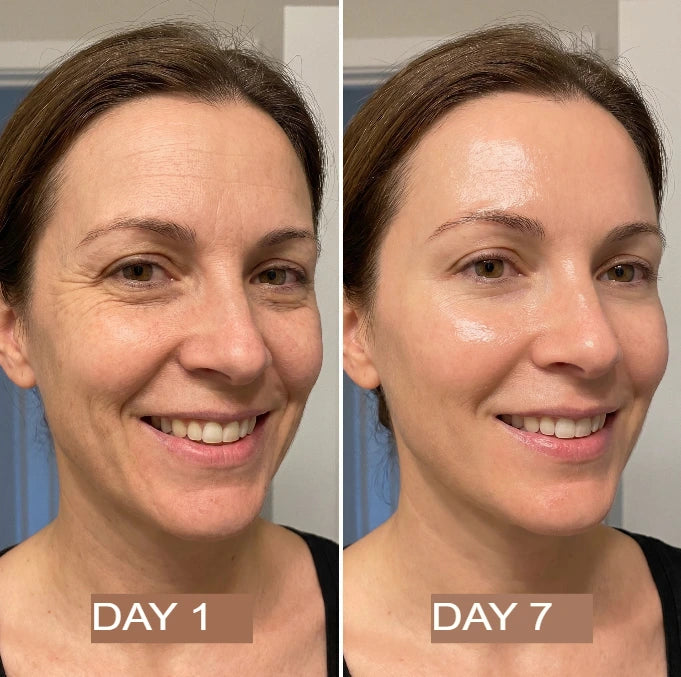 NeutraGlow™ Kollagenöl | Strafft und hebt schlaffe Haut innerhalb von 24 Stunden um 98 % an