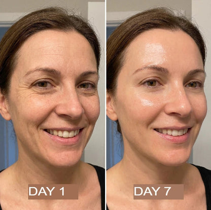 NeutraGlow™ Kollagenöl | Strafft und hebt schlaffe Haut innerhalb von 24 Stunden um 98 % an