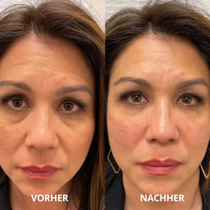 Neutra Glow™ Peptid-Kollagen Hydrogel-Augenpads