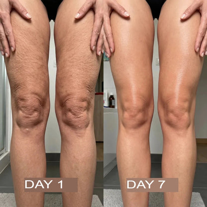 NeutraGlow™ Kollagenöl | Strafft und hebt schlaffe Haut innerhalb von 24 Stunden um 98 % an